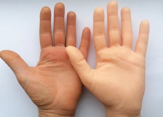  Autoridades confirmaron que el objeto hallado en la calle 20 de Noviembre era una mano de utilería de goma.